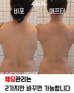 바디라인 핏관리