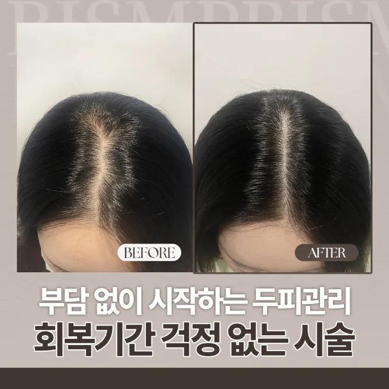 비스엠피