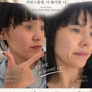 몰디브태닝 역북점
