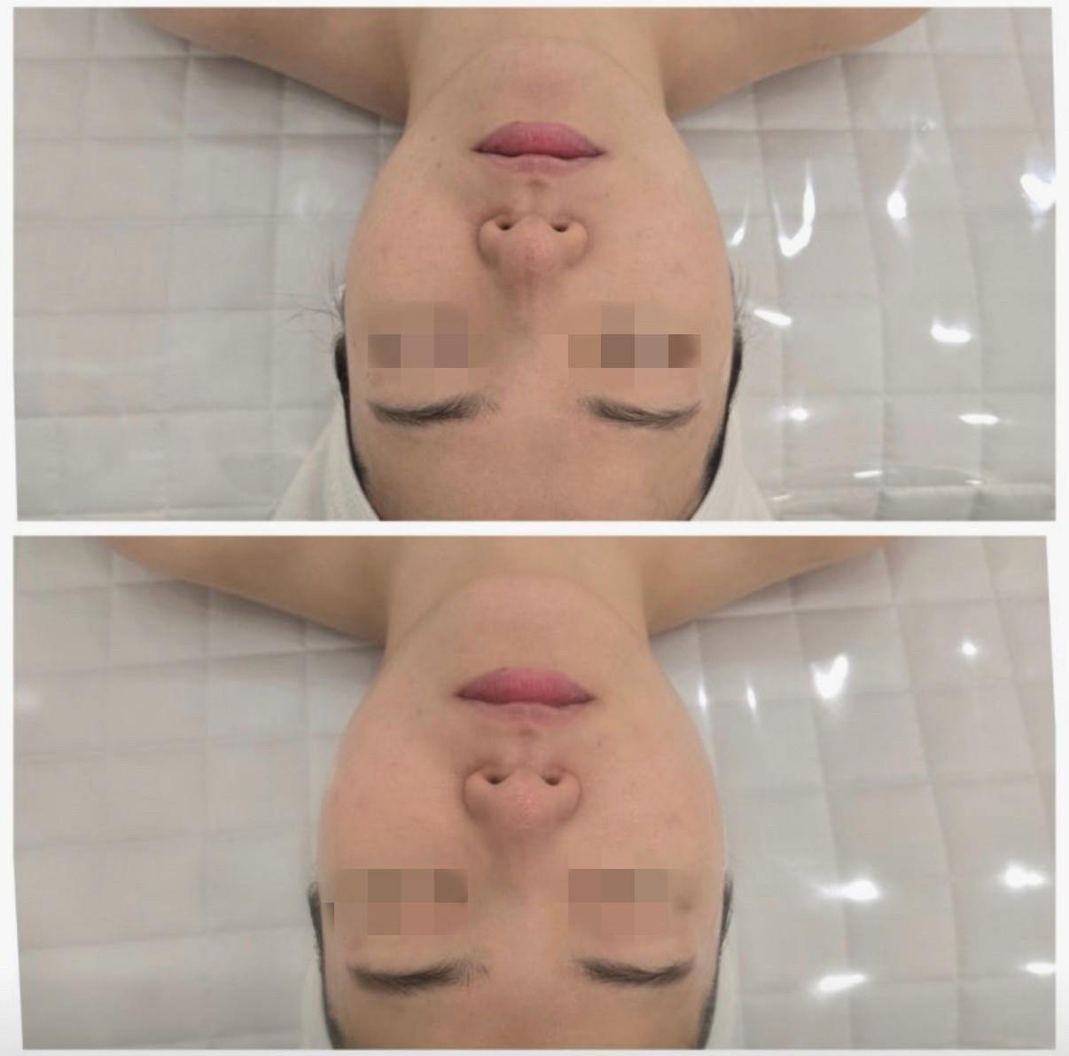 결담에스테틱 파주운정점