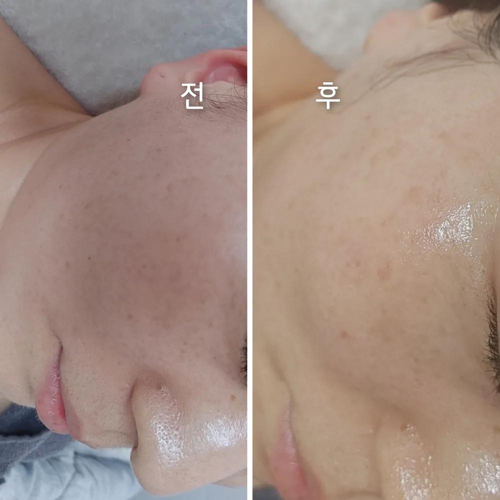 에스스킨엔바디