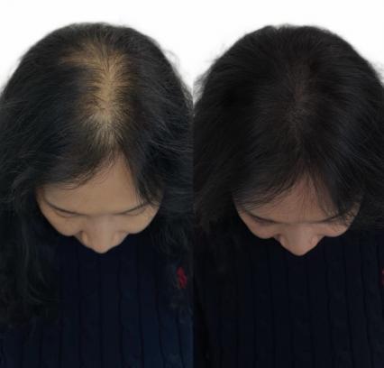 오소울산