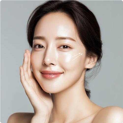 세르프
