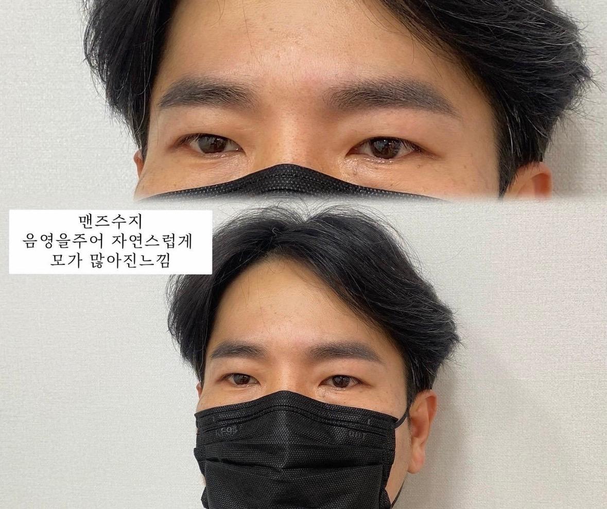 하이브로우 사진 2