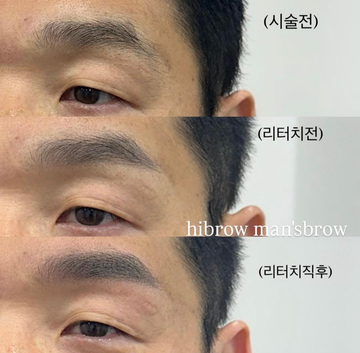 하이브로우 사진 3