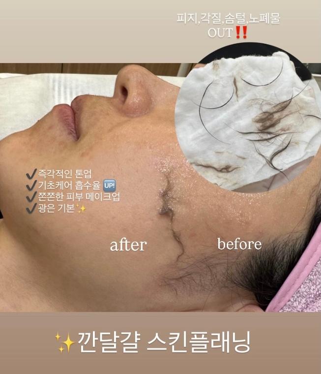 눈썹가게 천안(스킨플래닝)