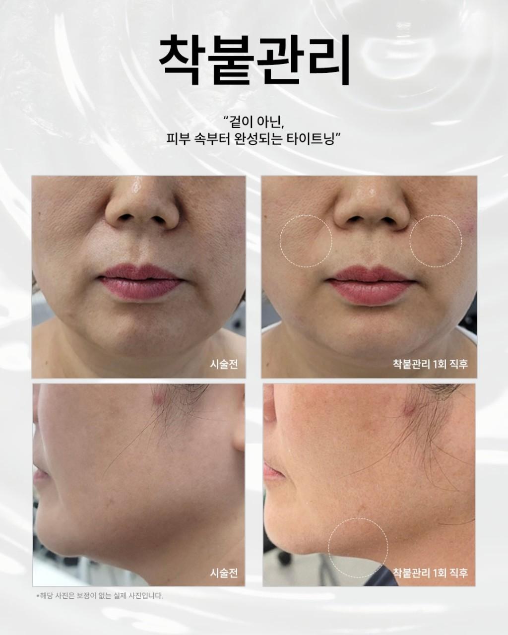 은월테라피
