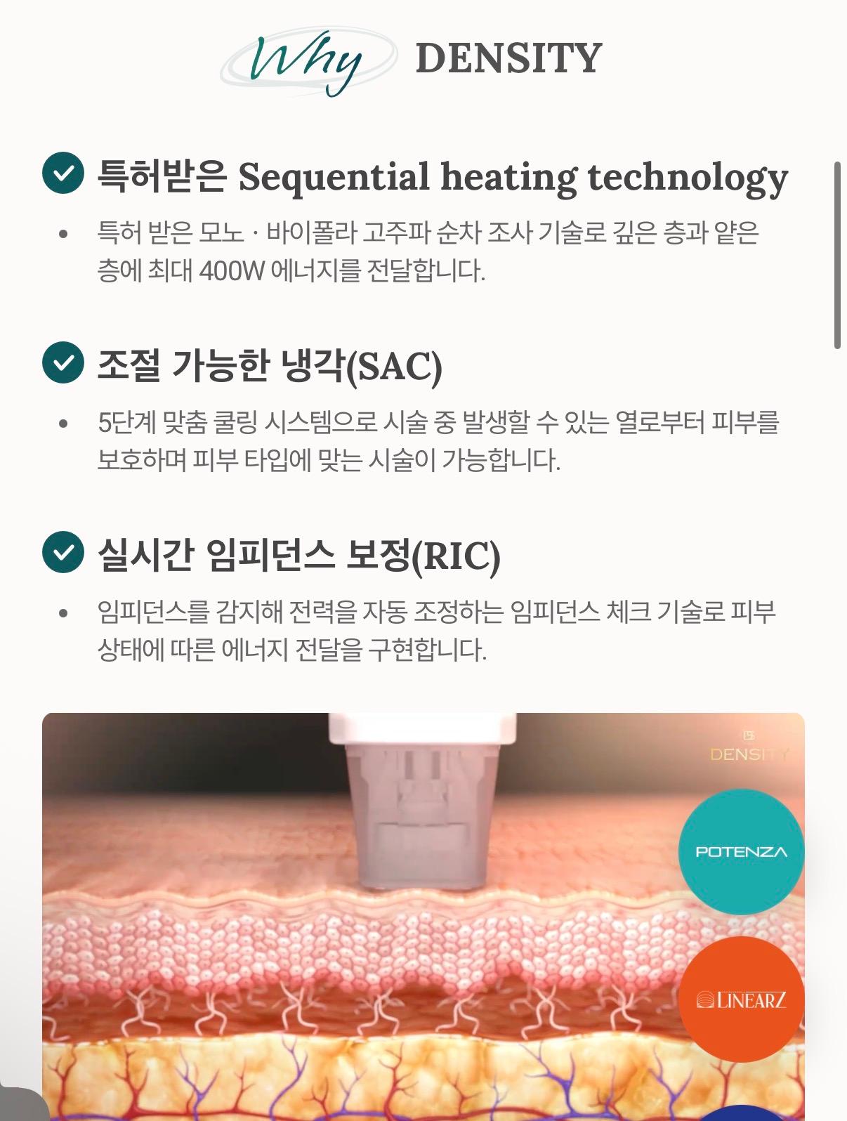 덴서티